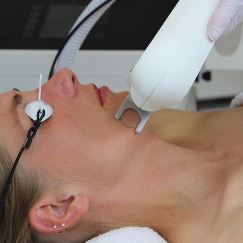 QuadroStar GREEN & YELLOW 1