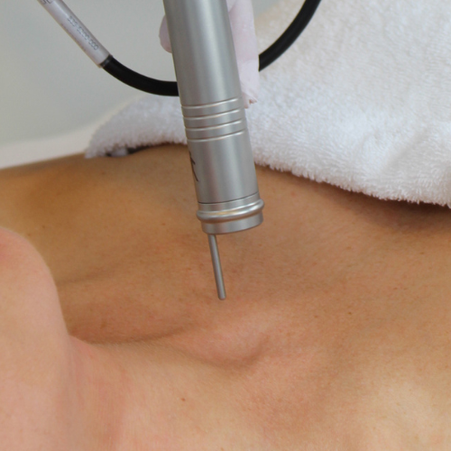 QuadroStar GREEN & YELLOW 2