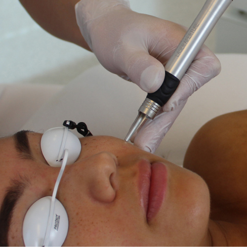 QuadroStar GREEN & YELLOW 3